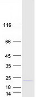 protq8ww01 c1orf19 tsen15 human recombinant protein