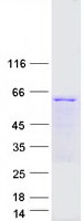 Coomassie blue staining of purified TCP11 protein