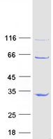 Coomassie blue staining of purified METTL21A protein