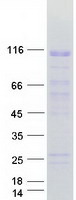 protq8wxb4 znf606 human recombinant protein