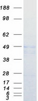 Coomassie blue staining of purified CPA5 protein