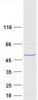 Coomassie blue staining of purified RSPH1 protein