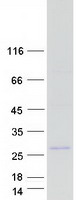 Coomassie blue staining of purified TMEM190 protein