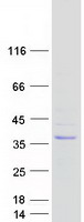 Coomassie blue staining of purified SUSD6 protein