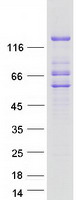 protq92539 lipin 2 lpin2 human recombinant protein