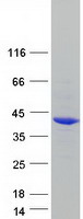 protq92561 phyhip human recombinant protein