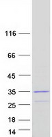 Coomassie blue staining of purified DCUN1D4 protein