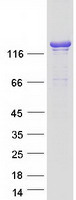 Coomassie blue staining of purified ARHGAP45 protein