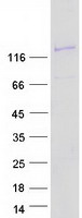 protq92797 symplekin sympk human recombinant protein