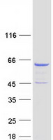 protq92828 coro2a human recombinant protein