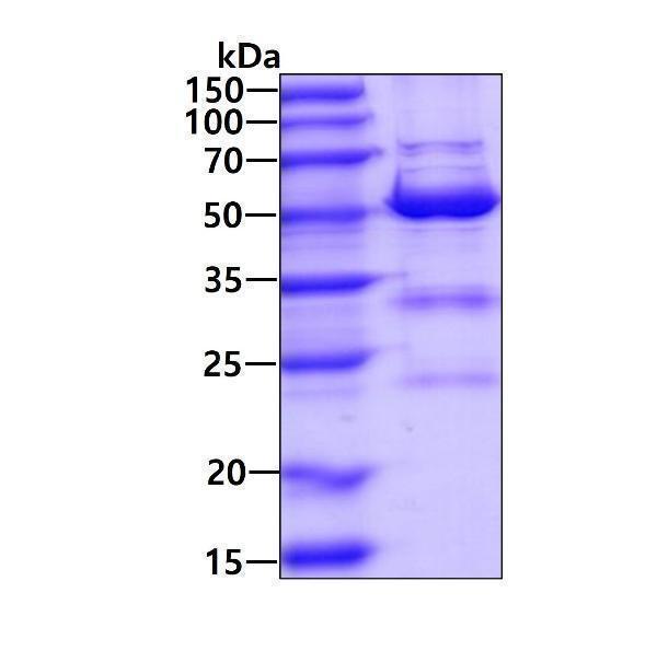 3ug by SDS-PAGE under reducing condition and visualized by coomassie blue stain