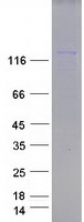 Coomassie blue staining of purified SMARCC1 protein