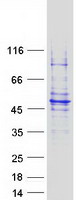 Coomassie blue staining of purified GCDH protein