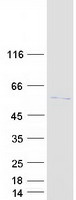 Coomassie blue staining of purified KAT5 protein