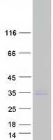 Coomassie blue staining of purified PMEPA1 protein