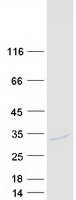 protq96at9 rpe human recombinant protein
