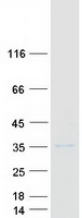 protq96bd6 spsb1 human recombinant protein