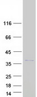 protq96bd8 ska1 human recombinant protein