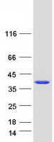 Coomassie blue staining of purified AIDA protein