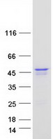 protq96bk5 pinx1 human recombinant protein