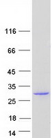 protq96bs2 tesc human recombinant protein