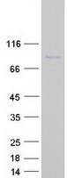 Coomassie blue staining of purified CENPT protein