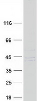 protq96bw5 pter human recombinant protein