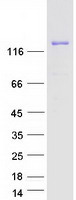 Coomassie blue staining of purified ULK4 protein
