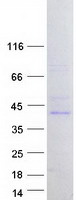 protq96cd0 fbxl8 human recombinant protein