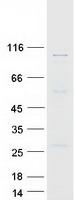 protq96cw5 tubgcp3 human recombinant protein