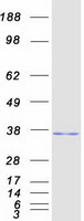 Coomassie blue staining of purified RASD2 protein