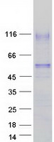 Coomassie blue staining of purified HAVCR1 protein