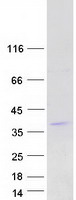 Coomassie blue staining of purified R3HDM4 protein