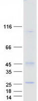 protq96dz7 tm4sf19 human recombinant protein