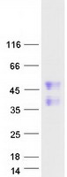 Coomassie blue staining of purified FAM122A protein