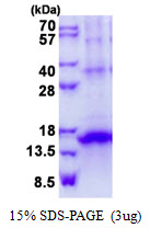 3ug by SDS-PAGE under reducing condition and visualized by coomassie blue stain.