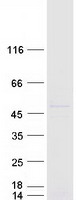 Coomassie blue staining of purified ELP4 protein
