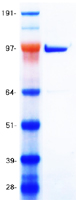 protq96eb6 sirt1 human recombinant protein
