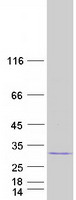 Coomassie blue staining of purified MALSU1 protein