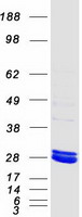 Coomassie blue staining of purified MMAB protein