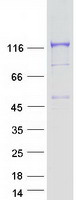 Coomassie blue staining of purified CYFIP2 protein