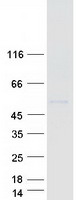 Coomassie blue staining of purified TRIM11 protein