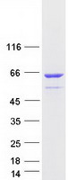 Coomassie blue staining of purified EDC3 protein