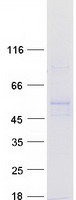 Coomassie blue staining of purified RRNAD1 protein