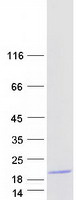 protq96fh0 mef2bnb borcs8 human recombinant protein