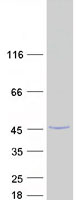 Coomassie blue staining of purified HMCES protein