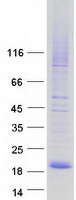 protq96fz5 cmtm7 human recombinant protein