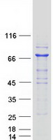 protq96g03 pgm2 human recombinant protein