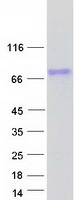 Coomassie blue staining of purified OTUD5 protein