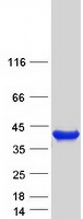 protq96ga7 sdsl human recombinant protein